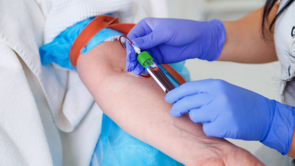 phlebotomist staffing at a laboratory testing facility